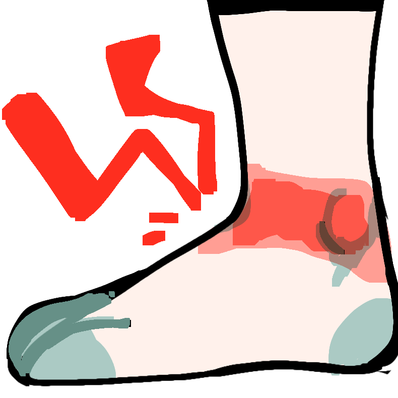 A light greyscale foot and lower leg, with a red ankle and pain lines radiating from it.